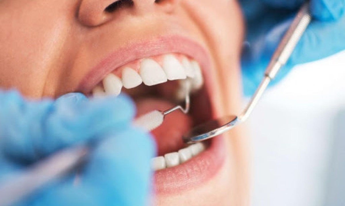 boca aberta sendo examinada por um dentista  -  (crédito: Divulgação/Governo MT )