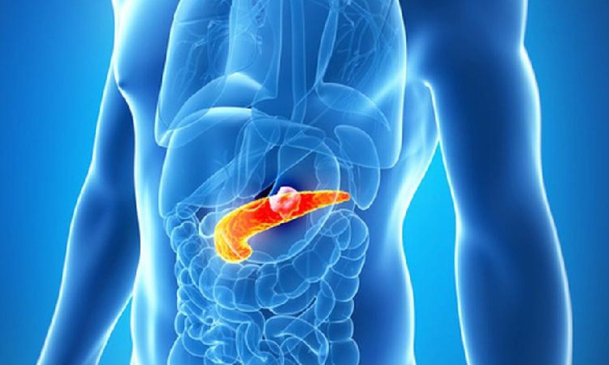 Ilustração de corpo humano com o pâncreas destacado -  (crédito: Getty Images)