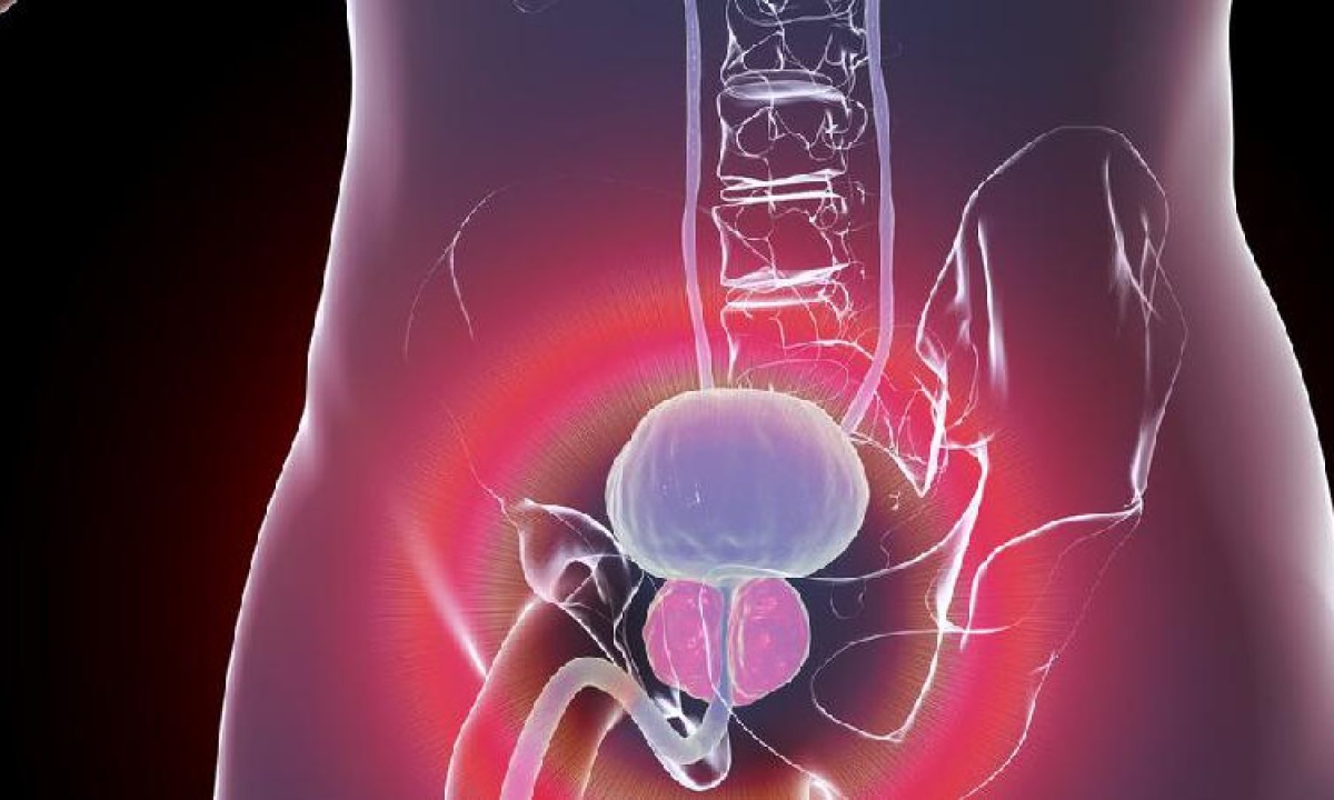 Ilustração próstata -  (crédito: Science Photo Library / Getty Images)