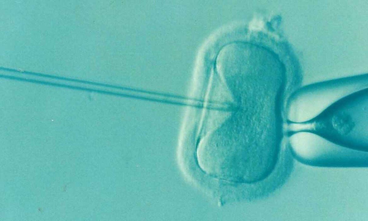 Imagem microsc&oacute;pica de insemina&ccedil;&atilde;o artifical. -  (crédito: TJMG/Divulga&ccedil;&atilde;o)