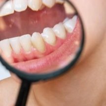 Como prevenir e tratar a sensibilidade nos dentes? - Freepik