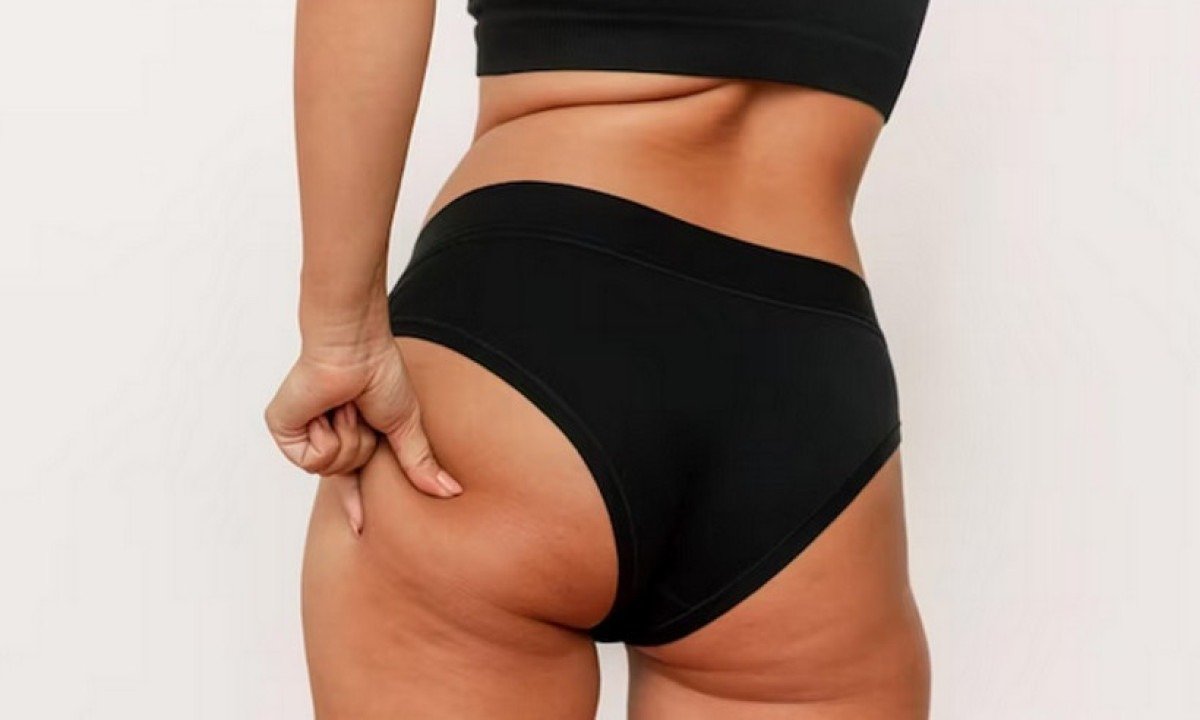 Não existe um bumbum perfeito, o que existem são ideais de beleza que não precisam, necessariamente, serem seguidos, mas pacientes podem buscar suas melhores versões -  (crédito: Freepik)