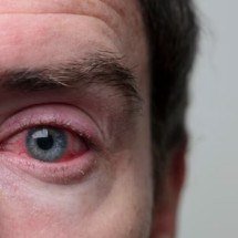 Homens estão raspando cílios em trend; saiba por que isso não é recomendado - Freepik