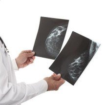 Plano de saúde terá que cobrir mamografia digital para todas as idades - Lana_M/Divulgação