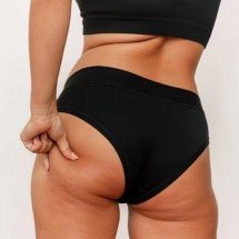 Harmonização glútea: você sabe o que estão aplicando no bumbum? - Freepik