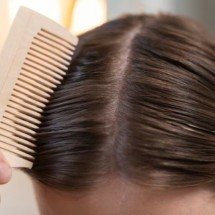 O que o inverno tem a ver com a queda de cabelo? Entenda essa relação - Freepik