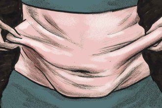 Emagrecimento acelerado com caneta pode provocar flacidez facial e corporal