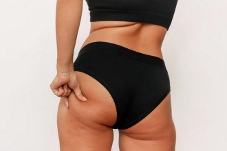 Harmonização glútea: você sabe o que estão aplicando no bumbum?