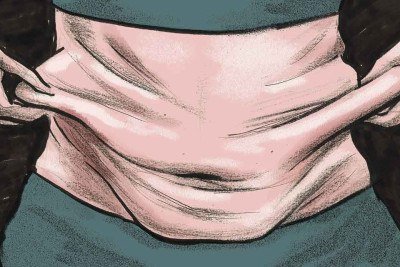 Ilustração sobre flacidez da pele -  (crédito: QUINHO)