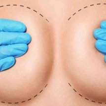 Cirurgia plástica estética x reparadora: quais as diferenças? - Letra Comunicação/Divulgação