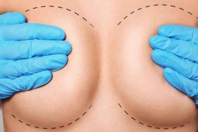 Cirurgia plástica de seios -  (crédito: Letra Comunicação/Divulgação)