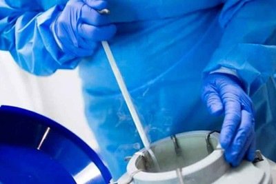 Procedimento de  congelamento de óvulos -  (crédito: Segs/reprodução)