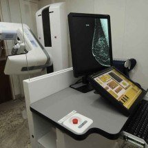 O detalhe milimétrico que muda tudo no diagnóstico do câncer de mama - Jair Amaral/EM/D.A.Press