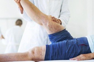 Varizes: a importância do acompanhamento especializado