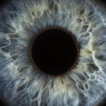 Retinose pigmentar: doença rara causa perda gradual da visão - Getty Images