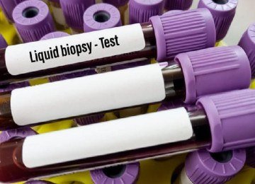 Tubos de sangue com uma etiqueta escrita 'biópsia líquida' -  (crédito: Getty Images)