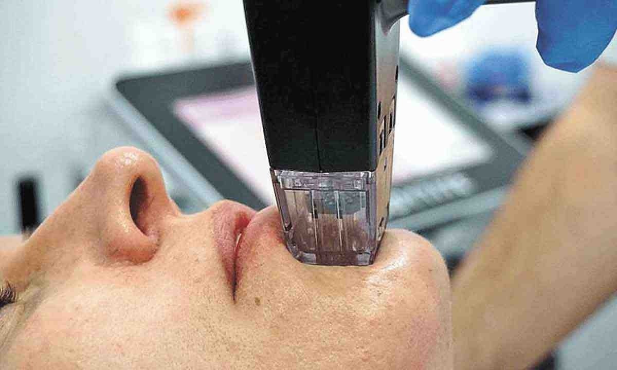 couro cabeludo com psoríase
 -  (crédito: internet/reprodução)