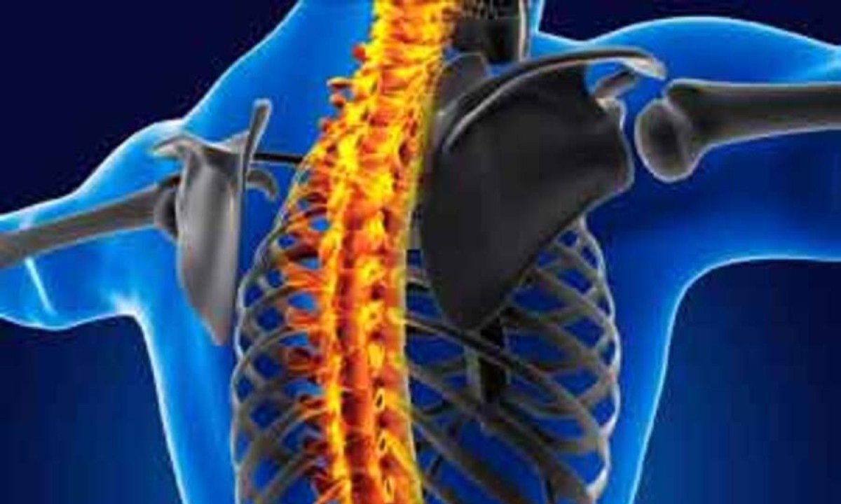 Neurocirurgião informa os cuidados que se deve ter para prevenir problemas na coluna -  (crédito: FREEPIK/Divulgação)