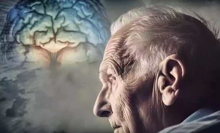 Alzheimer pode começar 20 anos antes dos primeiros sintomas  - Freepik