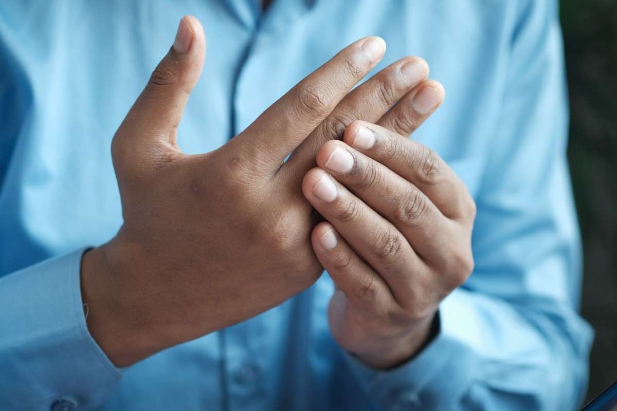 Como tratar da fadiga da artrite reumatoide no calor