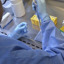 Vacina da chikungunya induz resposta imune em 98,8% dos vacinados - EBC - Saúde