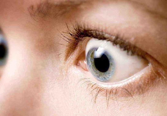 É possível perceber que os olhos do paciente com doença ocular da tireoide saltam para fora -  (crédito: SBPCO/Divulgação)