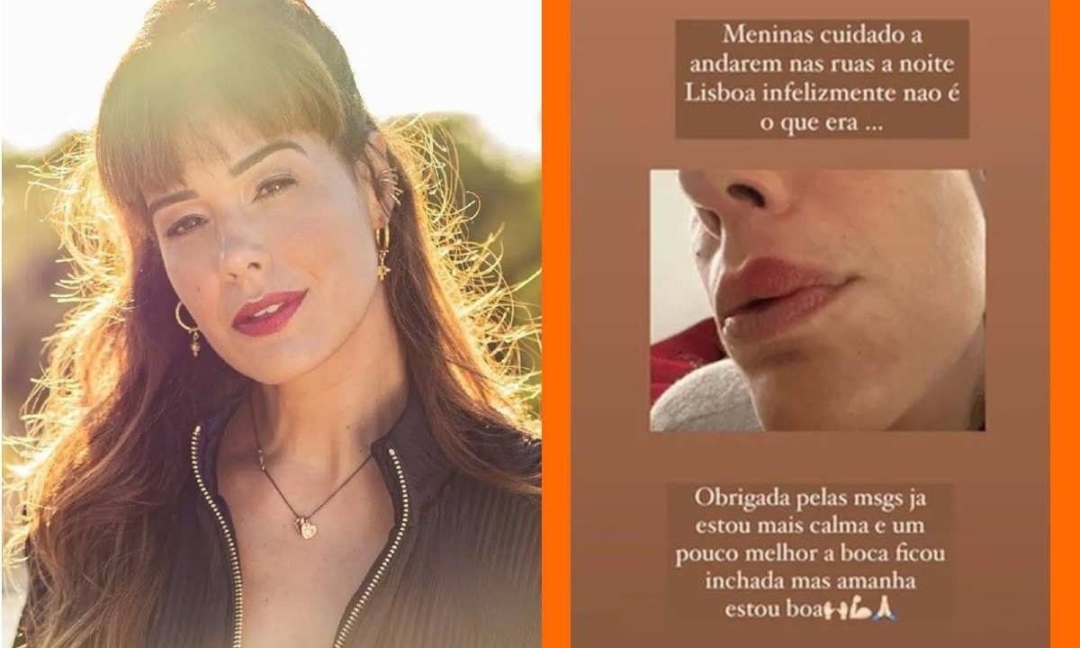 Atriz postou em redes sociais como ficou o rosto por causa da agressão -  (crédito: Reprodução/Instagram)