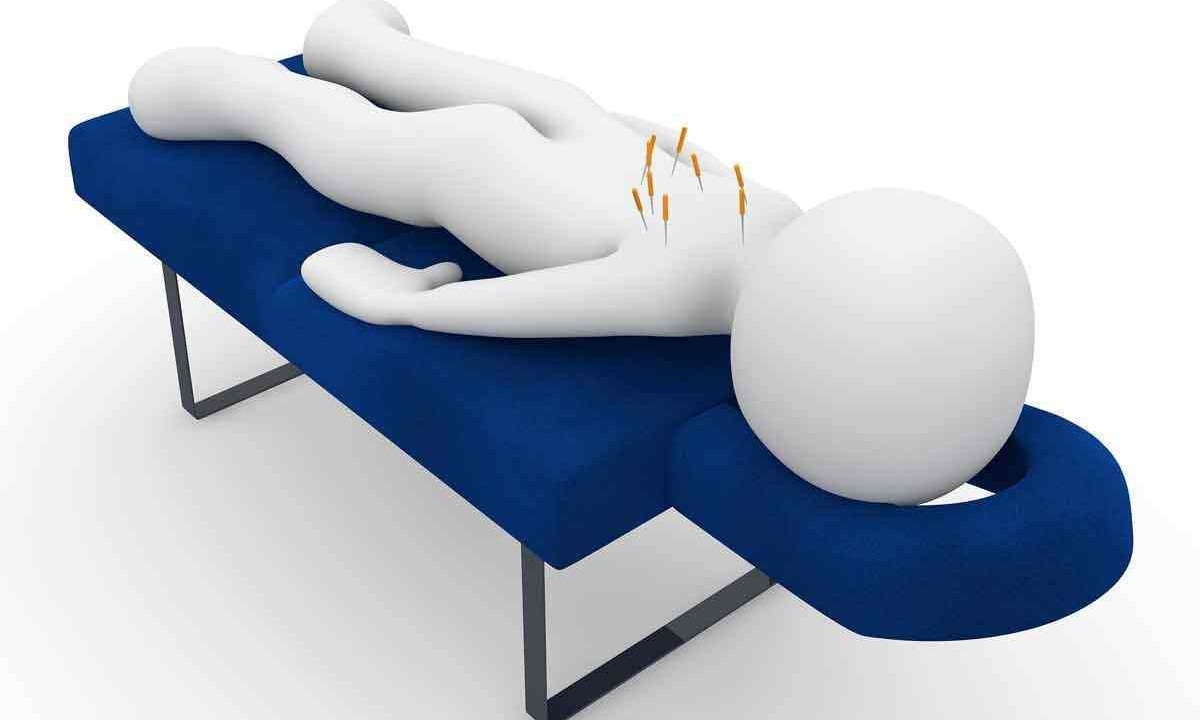 Ilustração de tratamento de acupunturar
- (crédito: PIXABAY/REPRODUÇÃO) Ilustração de tratamento de acupunturar
- (crédito: PIXABAY/REPRODUÇÃO)