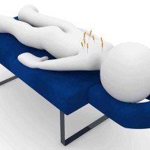 Acupuntura contra ansiedade? Especialista explica como é o tratamento - PIXABAY/REPRODUÇÃO