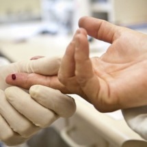 Casos de sífilis e de HIV/aids aumentam entre homens jovens - EBC - Saúde