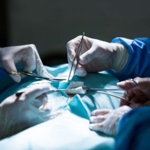 Transplante de órgãos cresce no Brasil, mas nível pré-pandemia ainda não foi atingido, diz relatório - peoplecreations