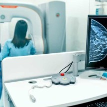 Mulheres com mais de 50 podem reduzir periodicidade da mamografia após câncer de mama inicial - Freepik