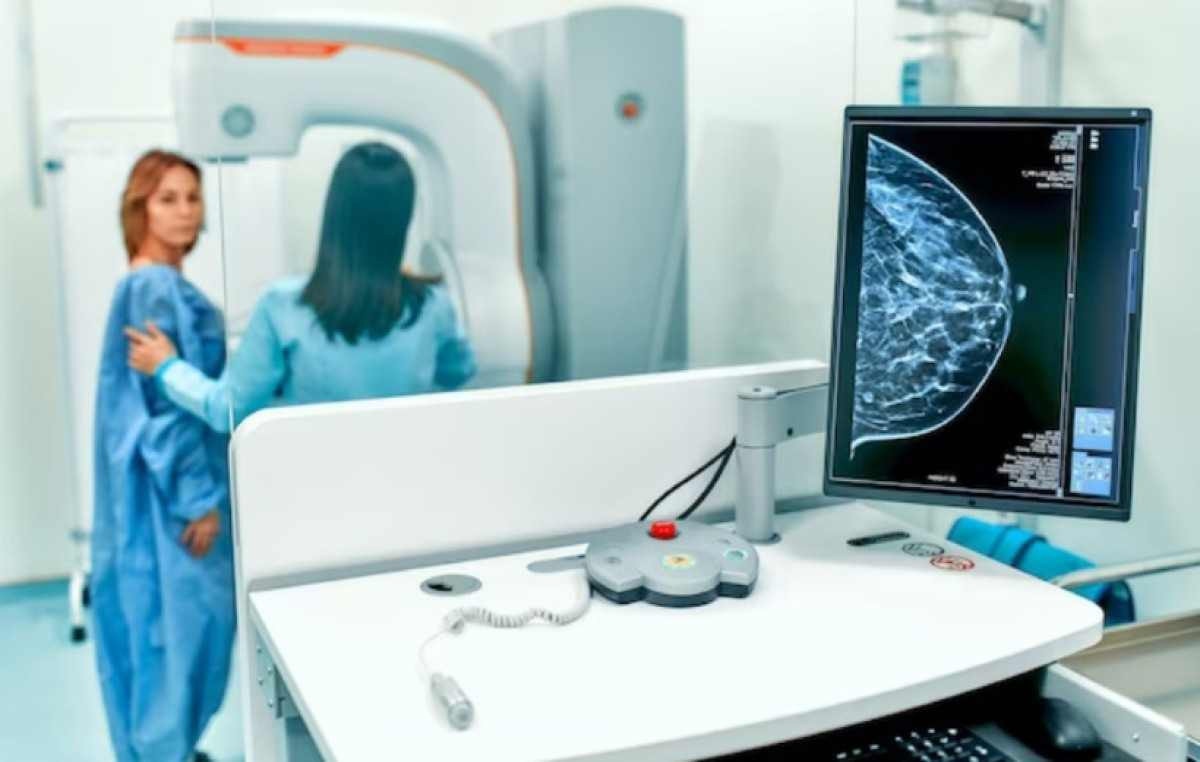 Mulheres com mais de 50 podem reduzir periodicidade da mamografia após câncer de mama inicial
