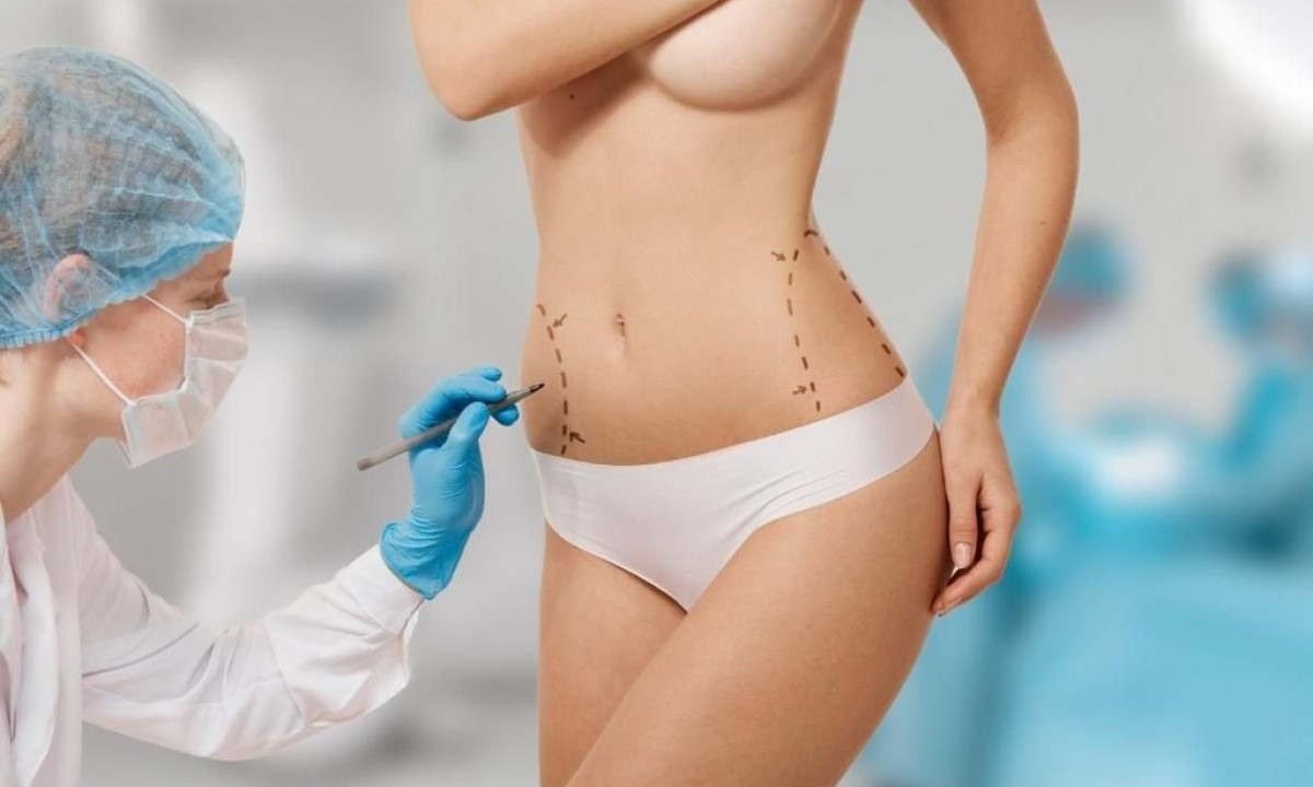 Muitas pessoas fazem cirurgia plástica no verão, mas é crucial adotar cuidados especiais durante a recuperação, especialmente sob o sol escaldante da estação -  (crédito: Freepik)