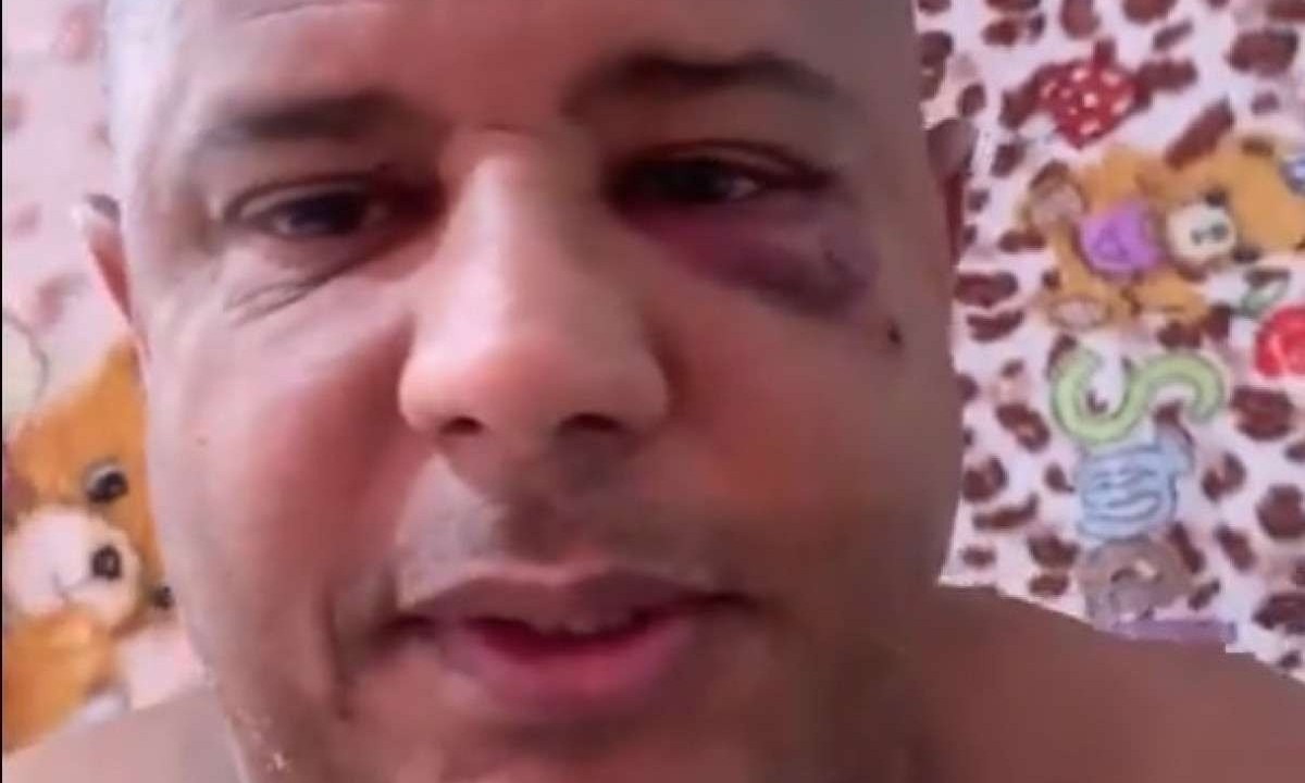 Marcelinho Carioca gravou vídeo com hematoma no olho explicando o sequestro -  (crédito: Reprodução)
