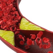 Colesterol: especialista reforça cuidados para o equilíbrio das taxas - Freepik
