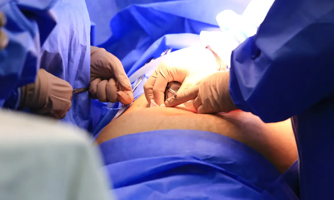 Cinco estados podem zerar fila de cirurgias no SUS  - EBC - Saúde