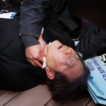 Político de oposição é esfaqueado no pescoço na Coreia do Sul - YONHAP / AFP