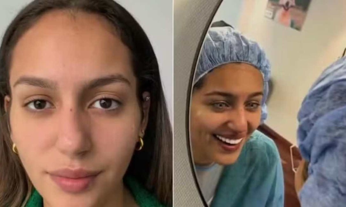 Jovem brasileira viraliza nas redes sociais e causa polêmica depois de submeter a uma cirurgia para mudar a cor de olhos de forma permanente -  (crédito:  Reprodução/X)