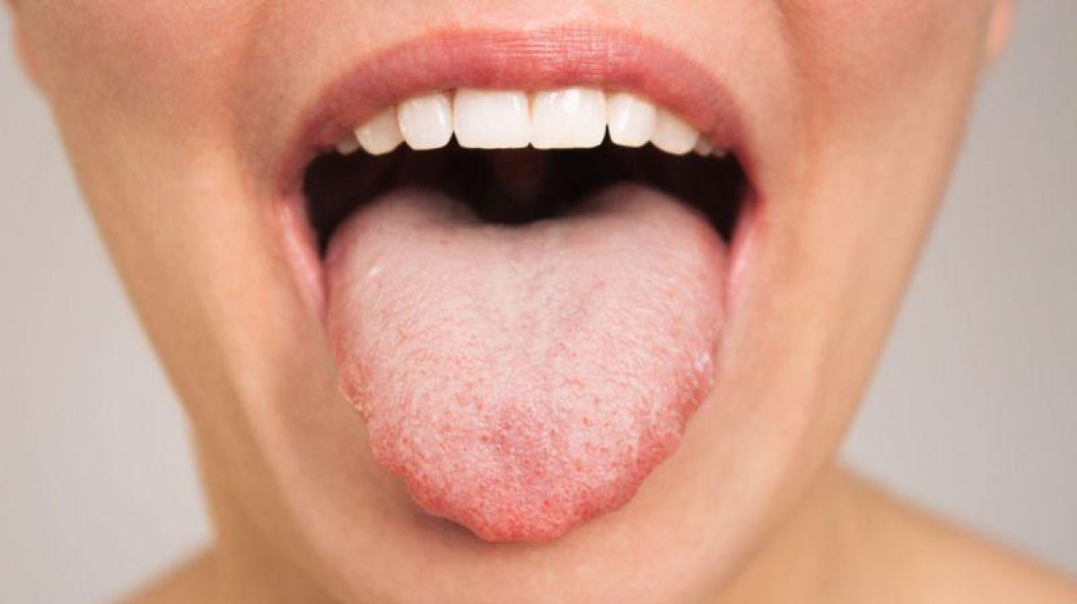 Dependendo da forma da sua língua, você pode gostar de alguns alimentos e odiar outros -  (crédito: Getty Images)