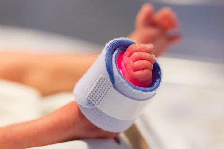 Os cuidados com os bebês prematuros. Veja o que fazer - SeppH - pixabay