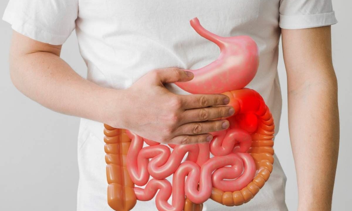 O transplante fecal transfere a microbiota de um indivíduo que tem bactérias benéficas para o paciente que está com a microbiota danificada -  (crédito: Freepik)