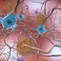 Alzheimer: novo teste promete mais eficácia no diagnóstico -  National Institute on Aging, NIH / Divulgação