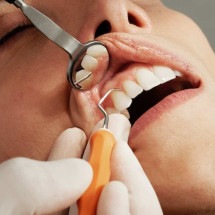 A importância da higiene bucal na saúde da população -  Caroline LM/Unsplash