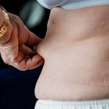 Obesidade é fator de risco para 13 tipos de câncer - Freepik