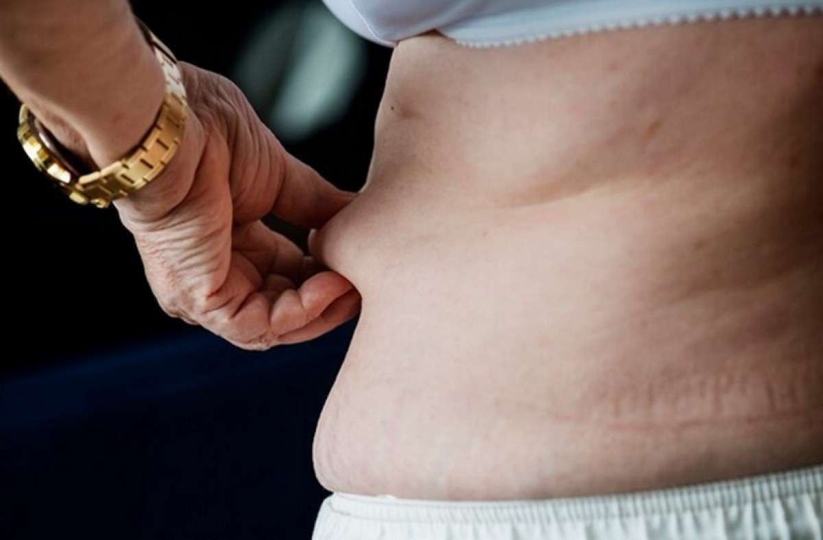 Obesidade é fator de risco para 13 tipos de câncer