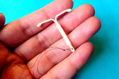 Imagem de um DIU (Dispositivo Intrauterino)  -  (crédito: Reprodução)