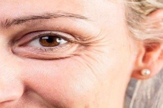 Nem toda linha é ruga: desidratação pode simular sinais de envelhecimento