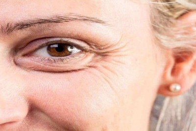 Rugas não são o único sinal de envelhecimento da pele
 -  (crédito: L'Oreal/reprodução)