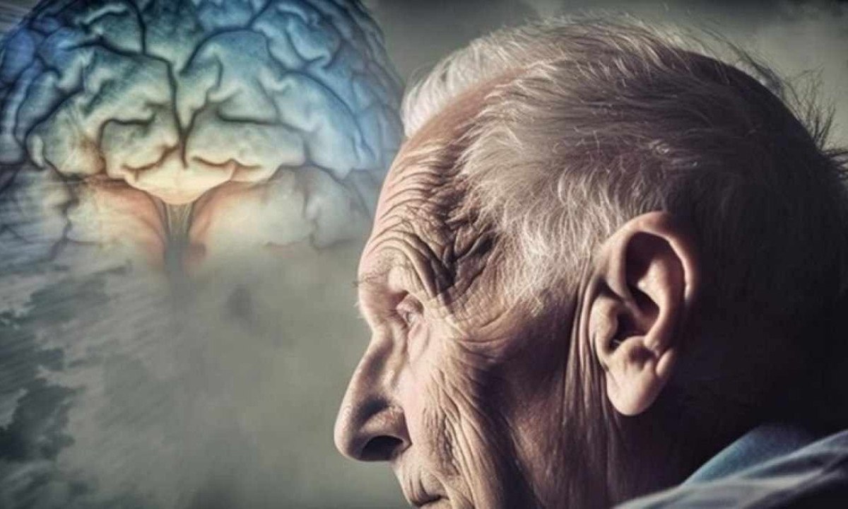 Alzheimer é responsável por cerca de 60% dos casos de demência -  (crédito: Freepik)